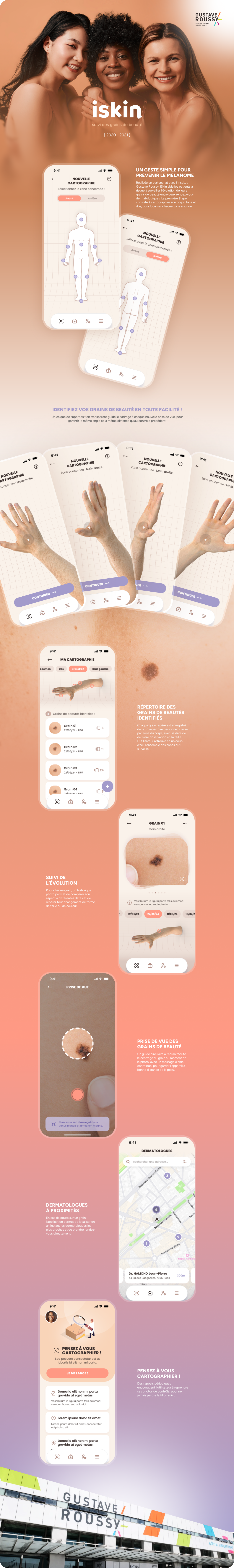 ISKIN — Suivi des grains de beauté